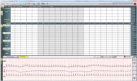 EC-3H kanal EKG Holter Sistemi