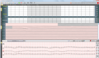 EC-3H kanal EKG Holter Sistemi